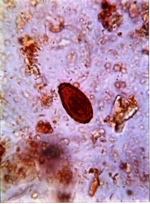  Clonorchis! รู้จักตัวสิงสารพัดโรคที่อาศัยอยู่ในตับของสัตว์มีกระดูกสันหลัง